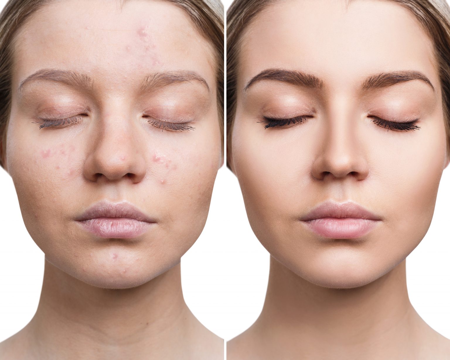 Acne Skin Cancer & Cosmetic Surgery Center of NJ