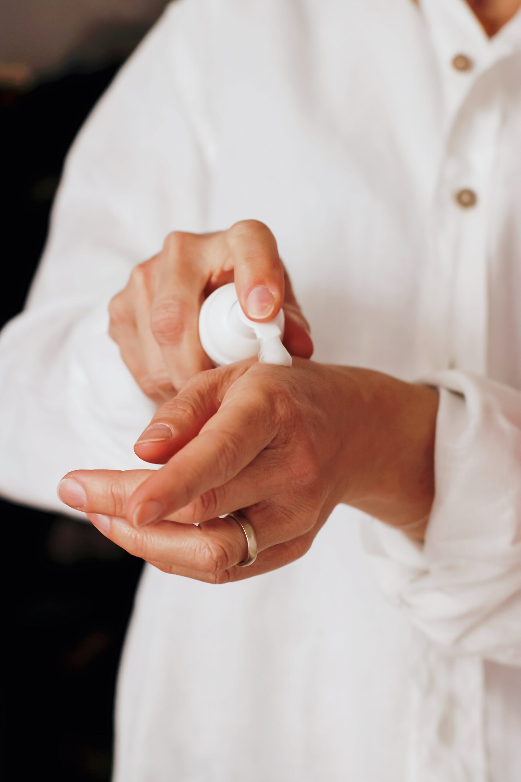 Person apply cream to their Woman with hypopigmentation spots