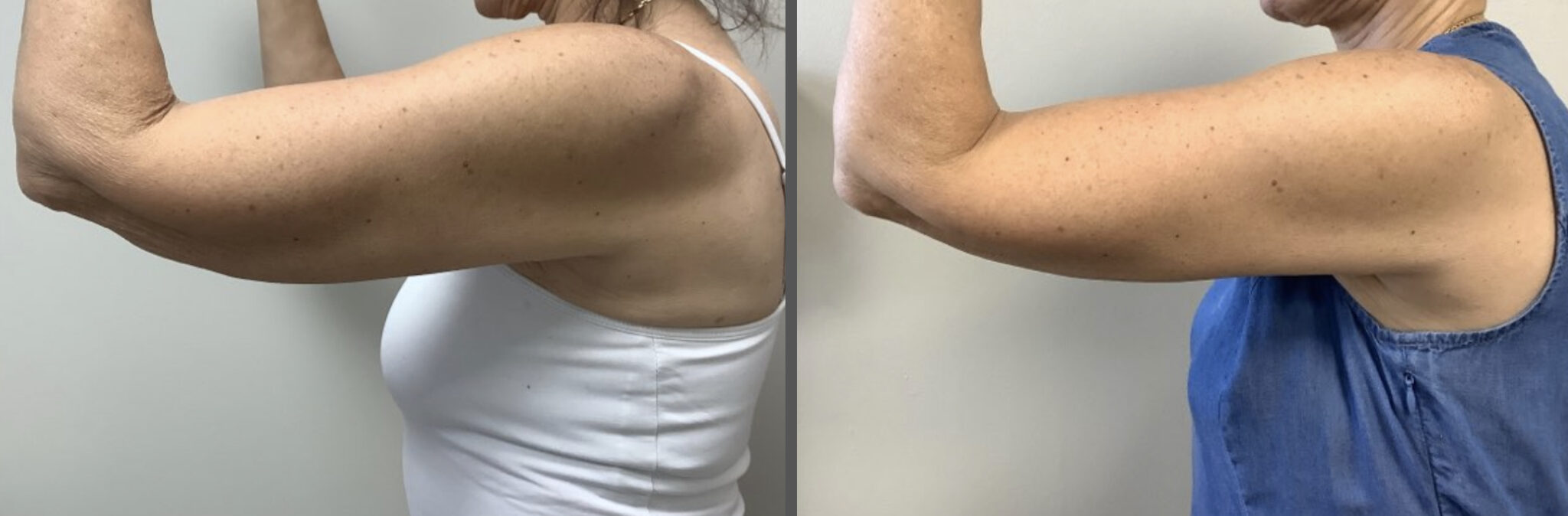 CoolSculpting® Skin Cancer & Cosmetic Surgery Center of NJ